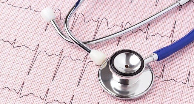 Electrocardiogram-Test-Lamson-Image-650x350