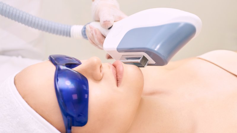 dermabrasion